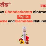 How Chanderkanta Cream Fights Acne and Blemishes