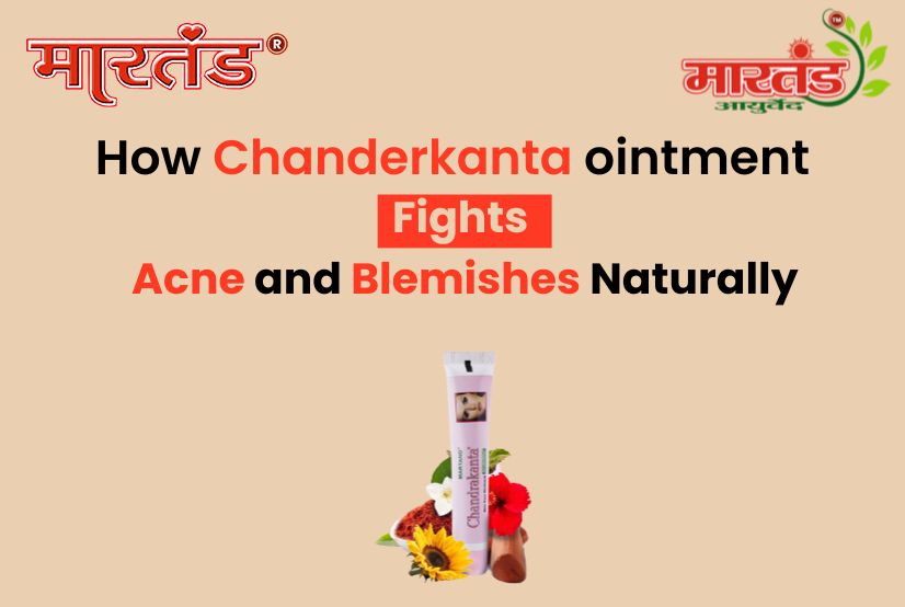How Chanderkanta Cream Fights Acne and Blemishes